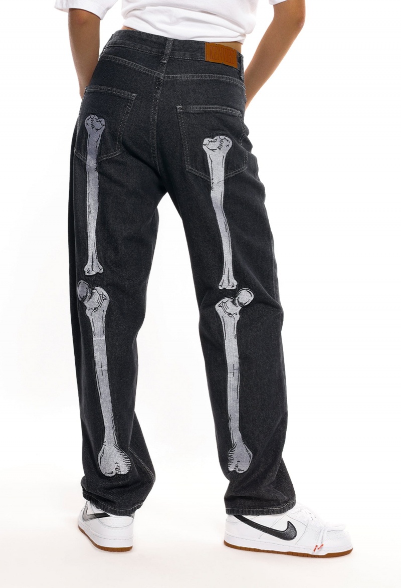 Jean Aelfric Eden Vintage Skull Bone Embroidery Noir | LKN-14596712